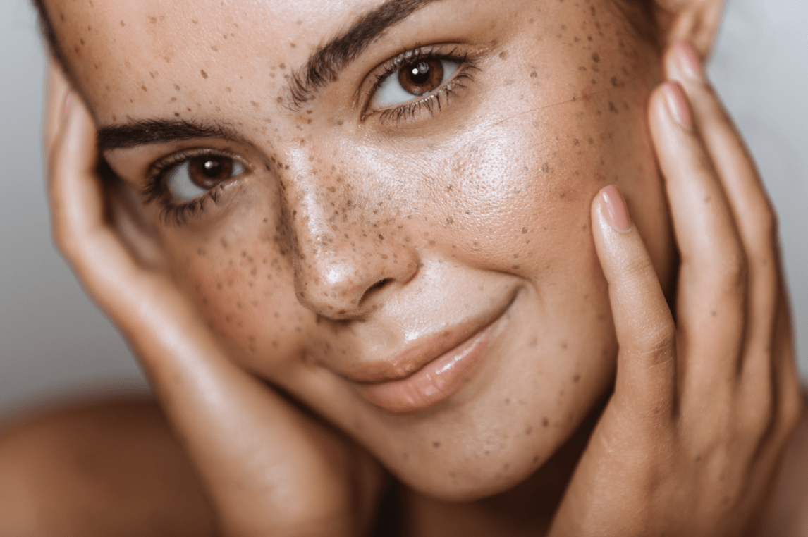 Understanding Compounded Skincare: The Benefits and How It Differs from Off-the-Shelf Products - My Skin Compounding Pharmacy