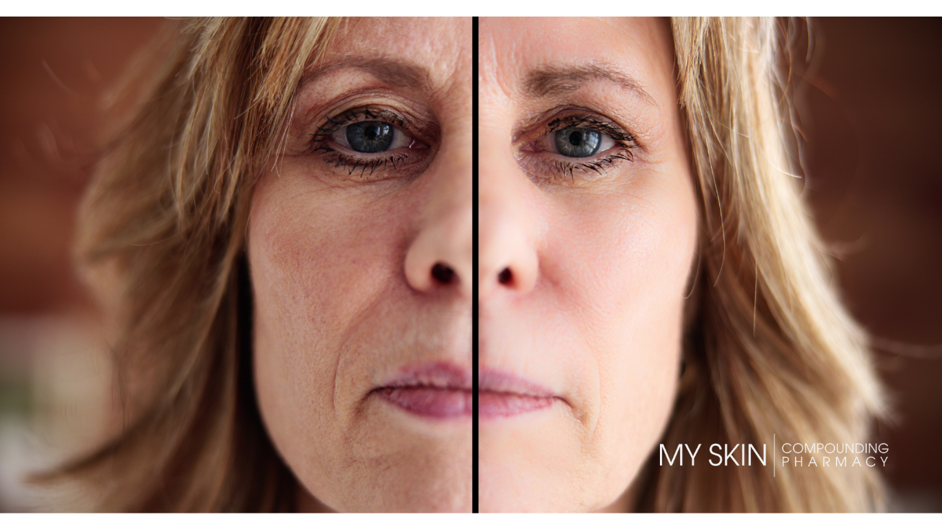 Can Rapamycin Reverse Signs Of Skin Aging? – TGVS