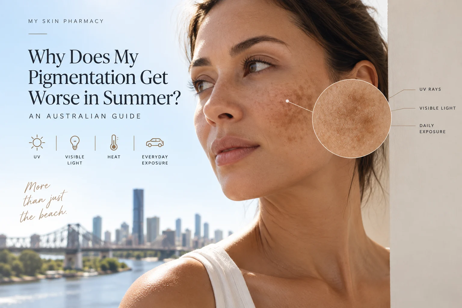Summer hyperpigmentation and melasma flare-up
