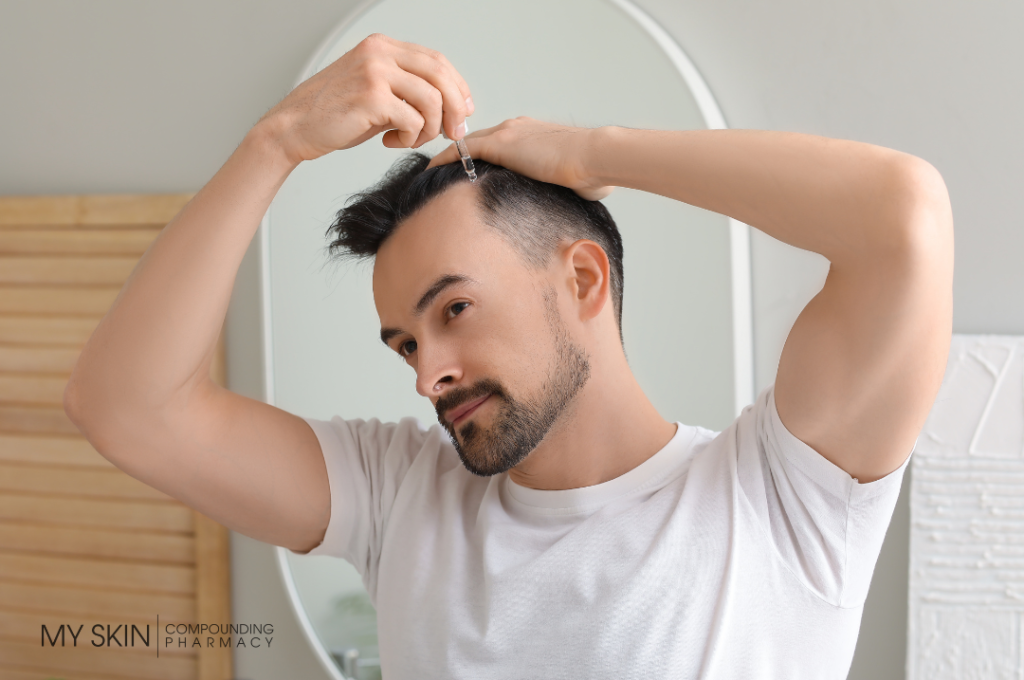 topical hair loss treatment