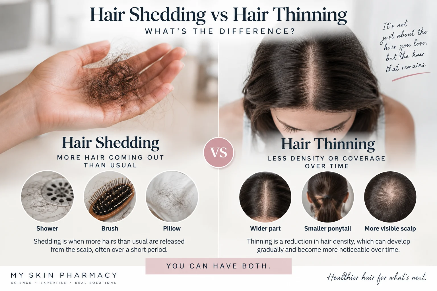 Woman checking scalp and hair density differences between hair shedding and hair thinning
